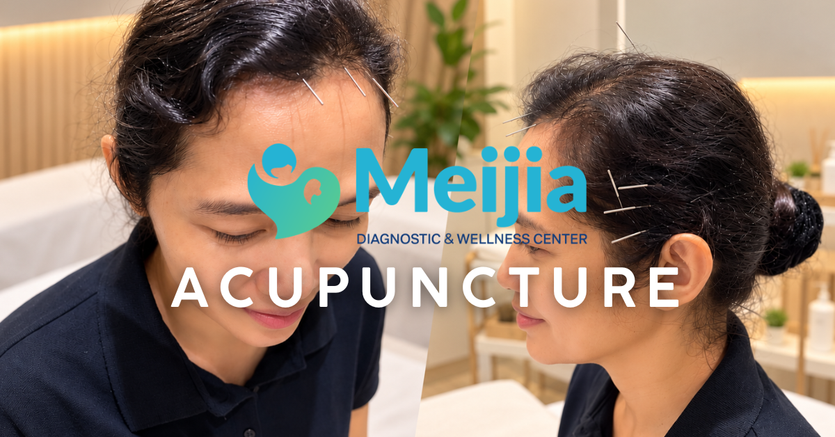 Acupuncture treatment at Meijia Diagnostic and Wellness Center